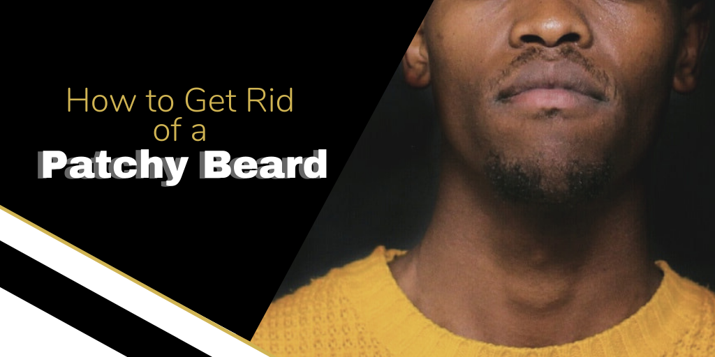 How To Get Rid Of A Patchy Beard