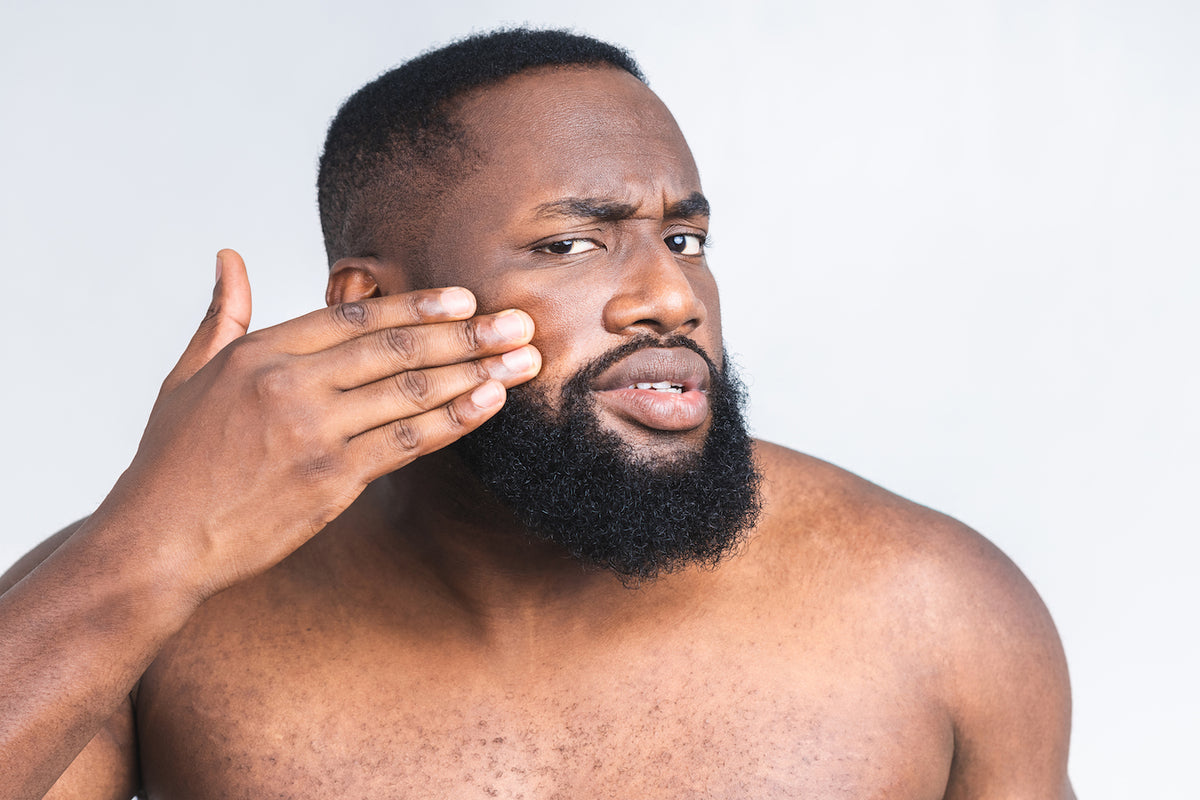 man applying beard balm